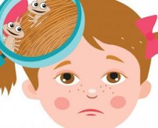 CHARLA SOBRE PEDICULOSIS EN INFANTIL